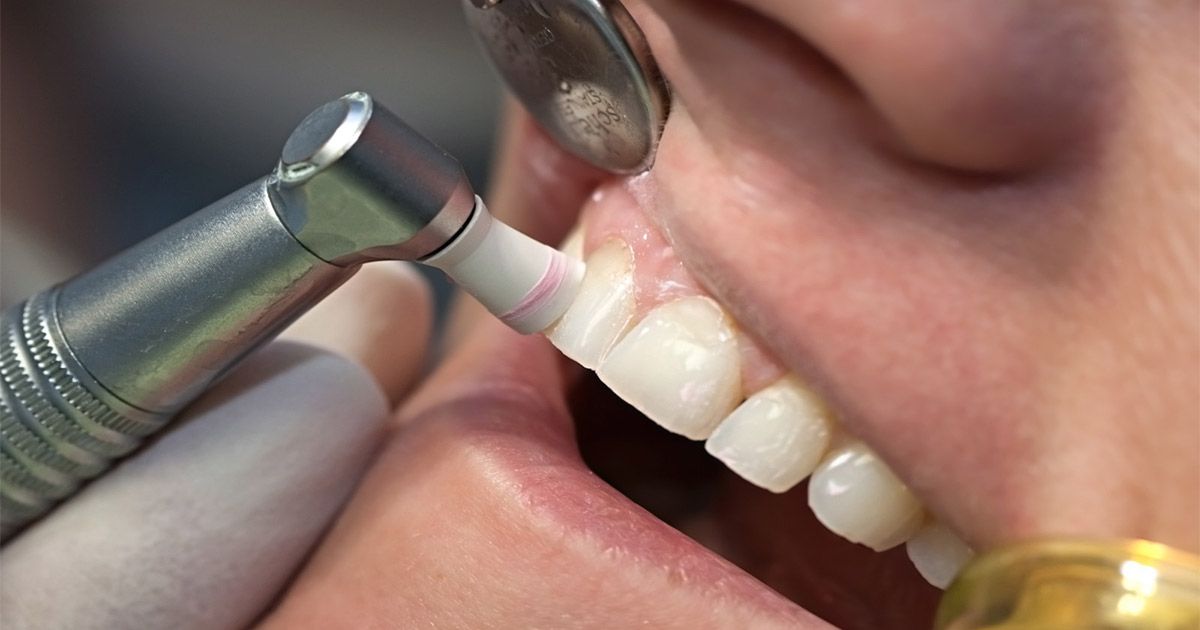 How-To-Remove-Coffee-Stains-From-Teeth-04e2a8e53153017d6d